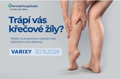 Trápí vás křečové žíly? Přijďte na Dny prevence varixů